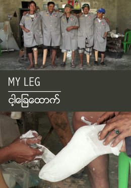 My Leg DVD Cover